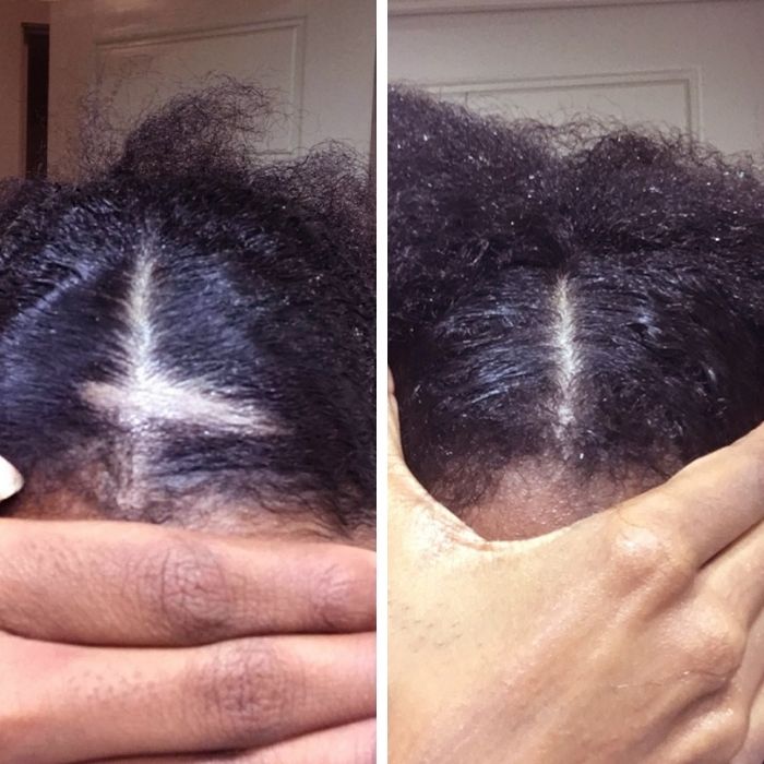 before after photo 1