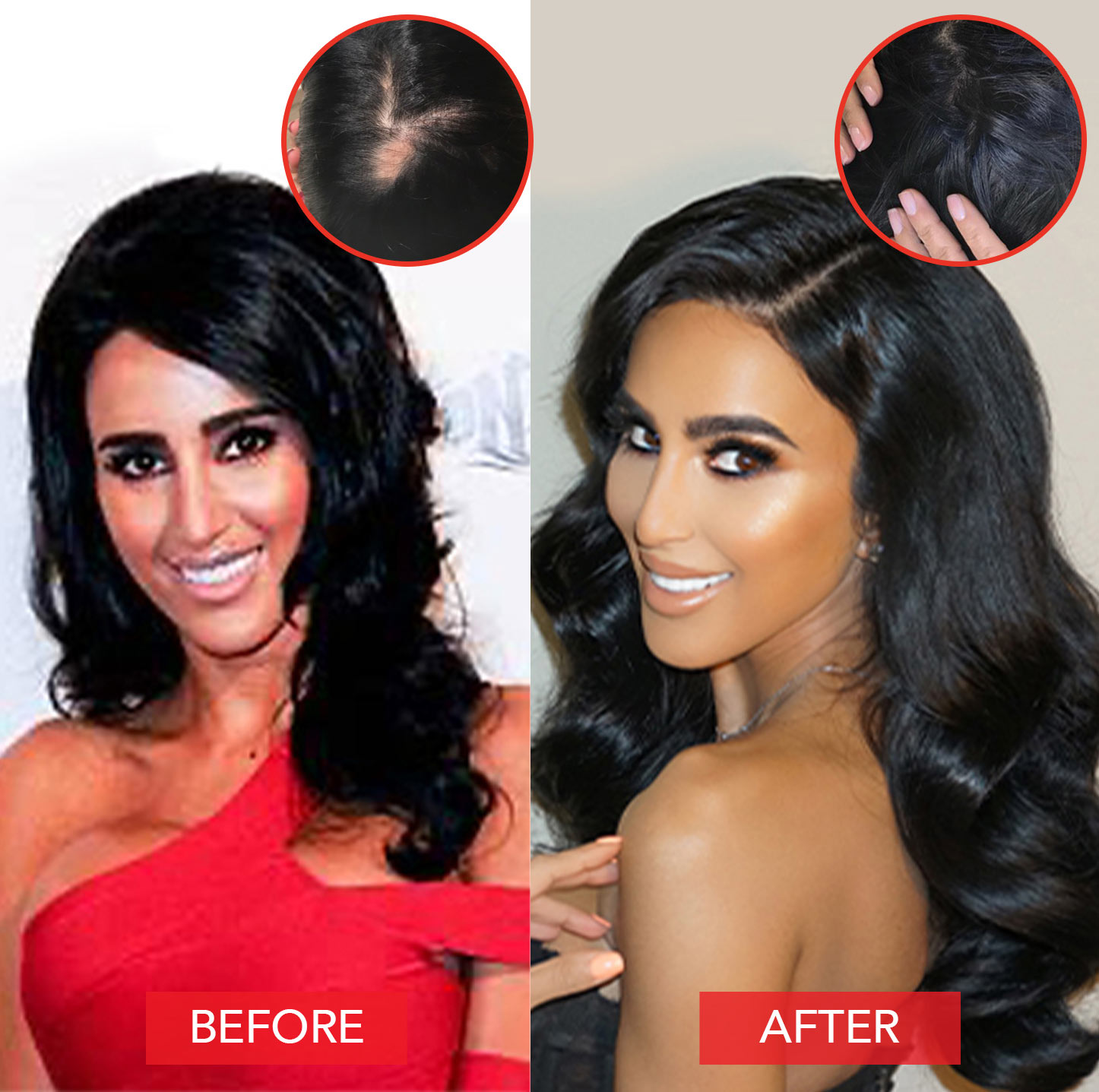 Lilly Ghalichi hair before and after